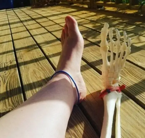 loyall)患有罕见的恶性肿瘤,于2016年4月接受了右腿膝盖以下的截肢