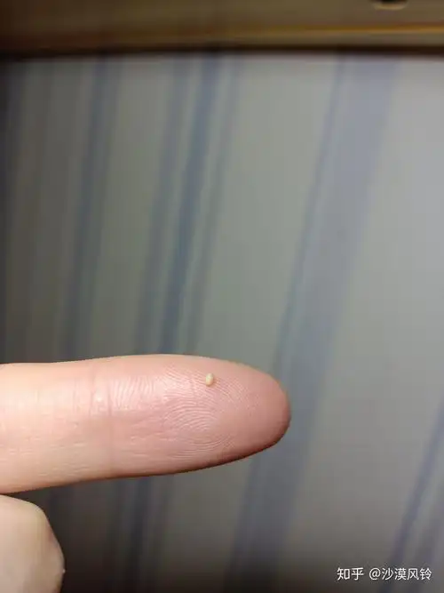 阴茎皮里面(皮下,非龟头上面)有几个颗粒样的东西,把阴茎皮扯起来摸有