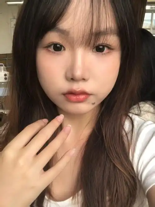 姐妹们帮我看看要不要把下巴这个痣切了 家人不让切说是有福 但是自己