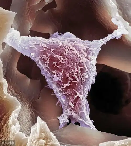 海拉细胞——源自宫颈癌的不死细胞!