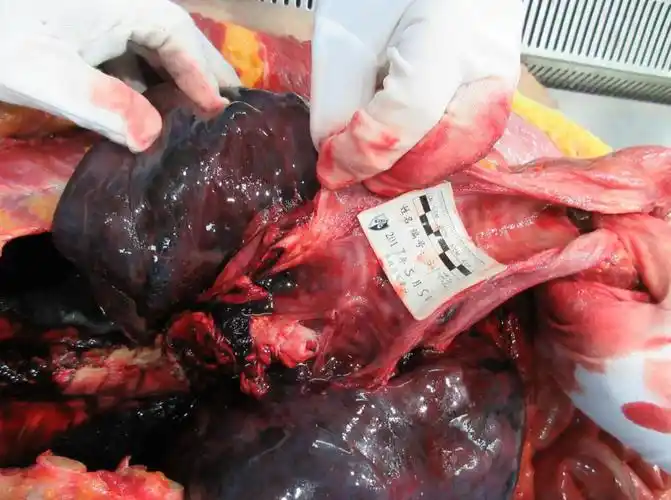 华东政法大学司法鉴定中心对一例纠纷后意外猝死当事人的法医病理鉴定