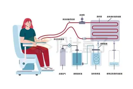 人工透析机血液透析机工作原理9139894矢量图片免抠素材