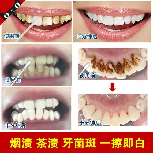 牙齿美白去牙渍去烟渍-仙人掌爱美丽丽