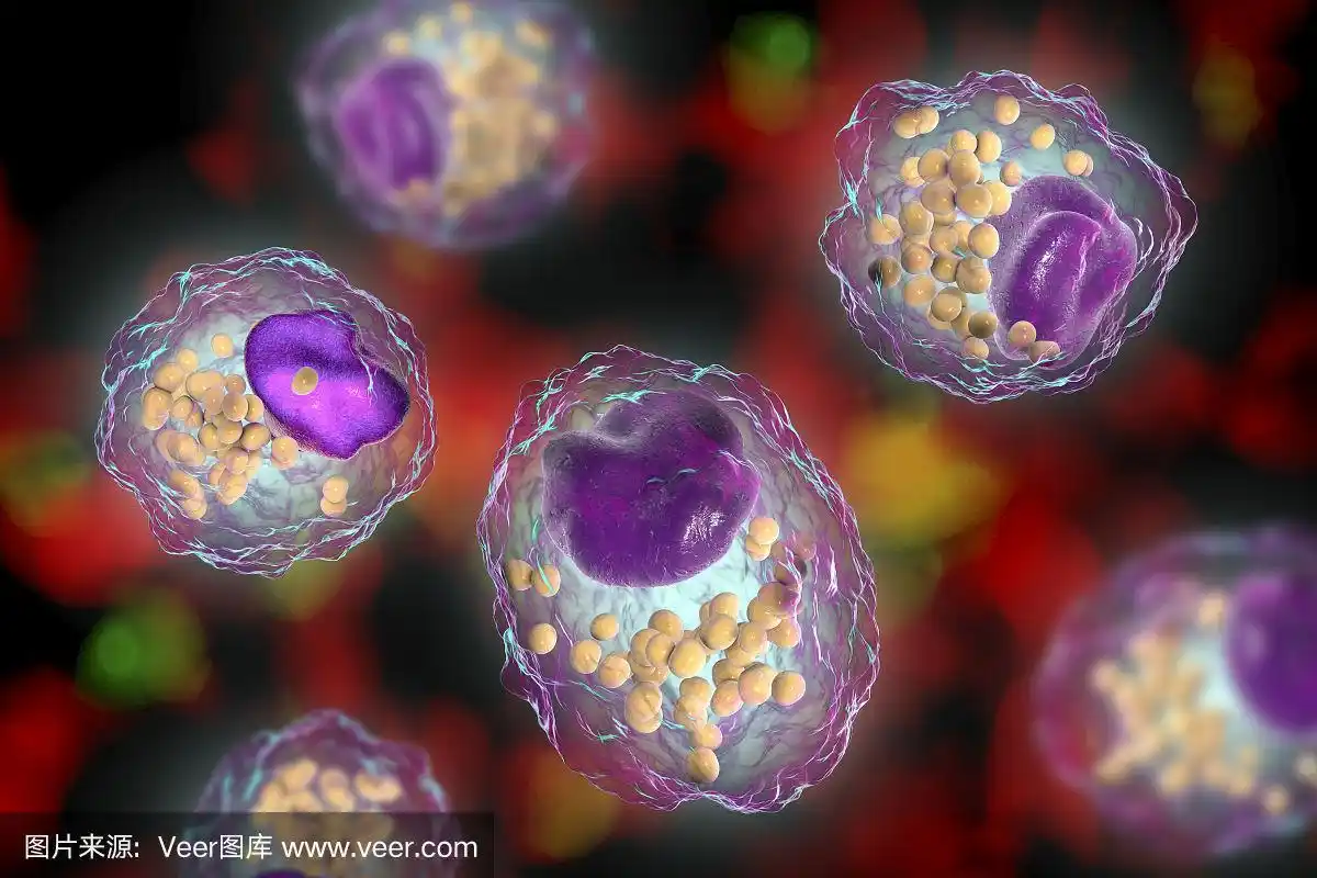 泡沫细胞,一种带有脂滴的巨噬细胞