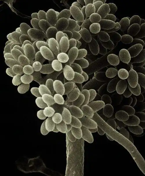 灰霉菌菌丝看着也很漂亮的嘛