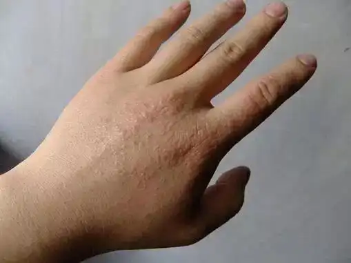 手伸出来瞅一眼上面这个东西多竟然易患高血压