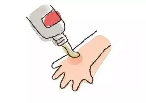 否则会加重皮肤损伤,影响愈合;水流要适度,不要太急冲破水泡;如果烫伤