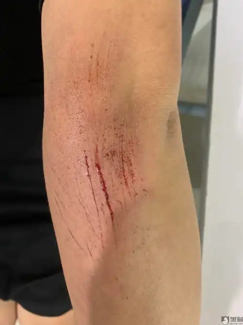 在江西省上饶市信州区使用小呗共享单车,因为车辆故障