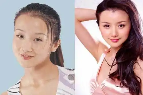 孙菲菲自导踩裙门炒作 刚出道时的土气照