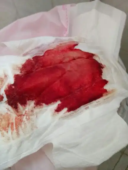 月经有异味,颜色淡淡的,周期32天,这个颜色正常吗?