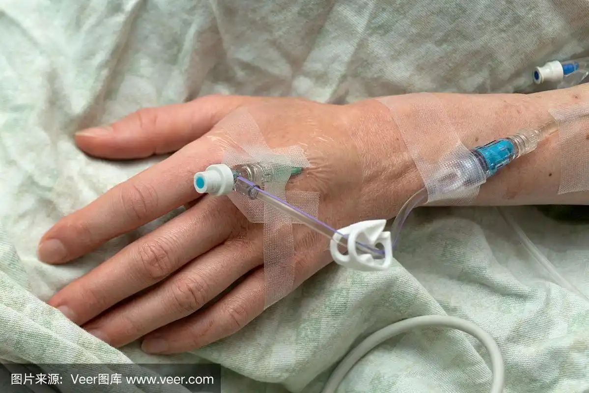 女人的手拿着静脉注射针和管子