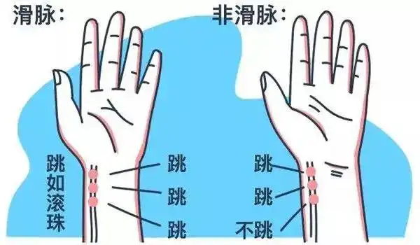 辨别八种重要脉象,看完这篇就可以了!