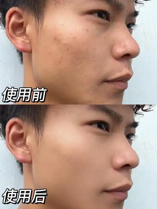 出门也是整个人不自信
前段时间在网上冲浪选择了oiu家的男士素颜霜