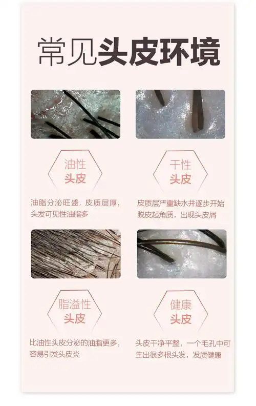 【毛囊检测】专业检测头皮健康状态 脱发级别 毛囊坏死程度 毛