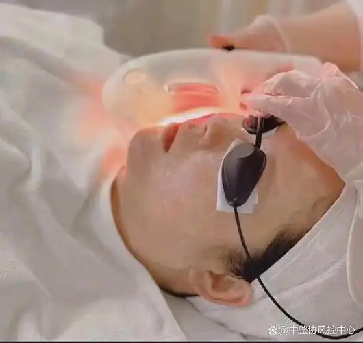 光电操作师是不能做光子嫩肤的!