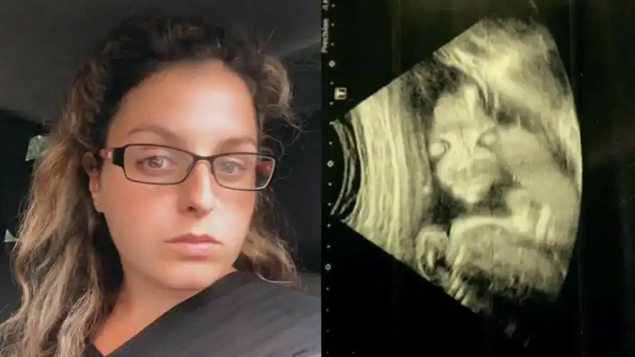 女子怀孕20周开心照b超,看到胎儿影像不淡定了:长相似"恶魔"