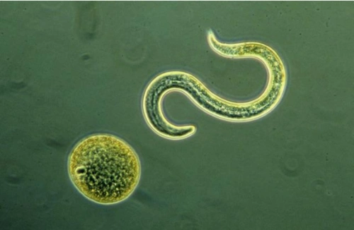 什么是弓形虫?有什么危害?弓形虫病需做什么检查?