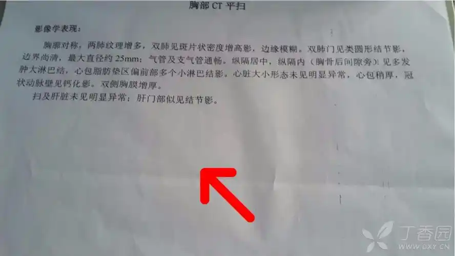 ppd强阳性,治疗后占位反而增大? [病例帖]