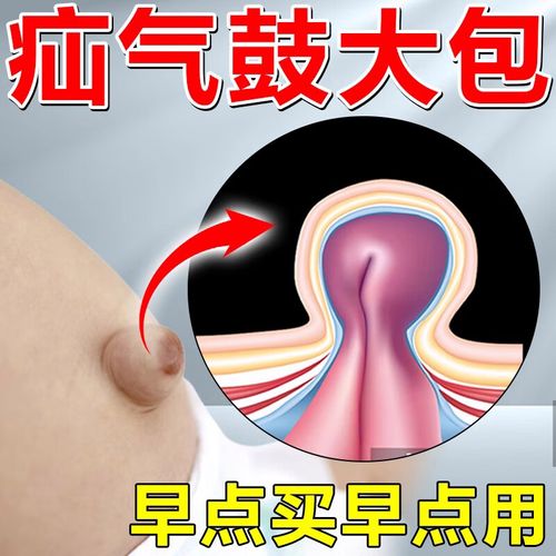 护脐专用解腹股沟疝气中老年人成人儿童小肠斜疝脐疵直疝切口保健贴