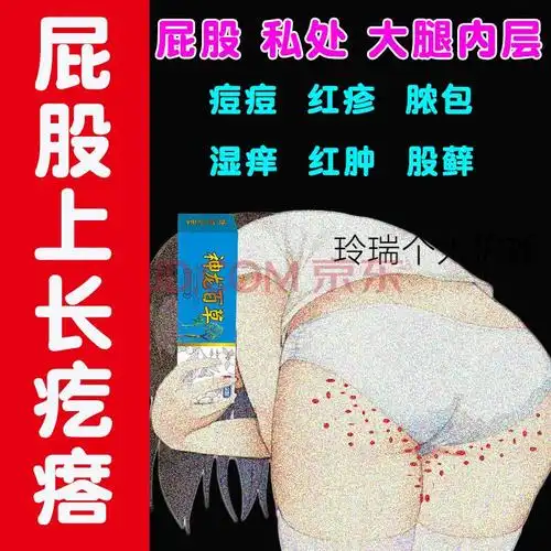 屁股上有疙瘩久坐屁股上长痘痘屁股痒股l藓屁股疮屁股湿l疹杀菌止痒 1