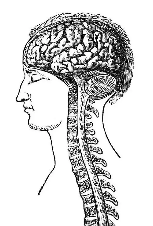 脊髓空洞症治好的希望大吗
