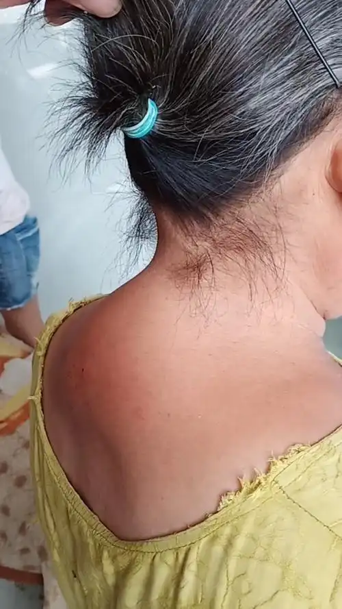 这样颈椎富贵包很危险!