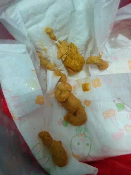 宝宝五十天拉的屎正常吗?