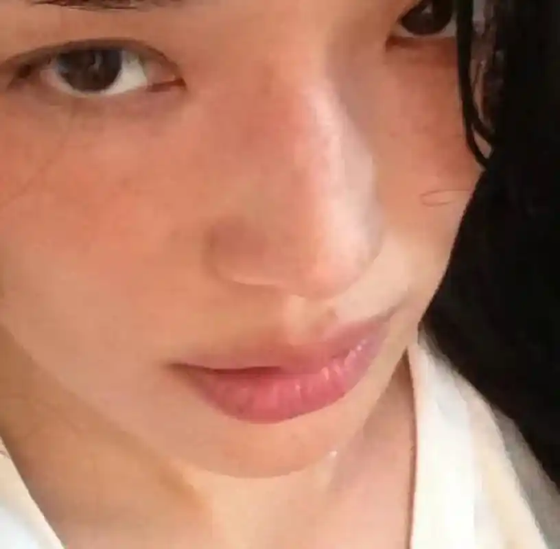 舒淇脸上雀斑这么多