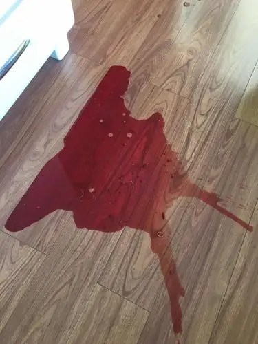 确诊得了细小第三天和第四天都拉血了,拉的血中有白色虫子怎么回事?