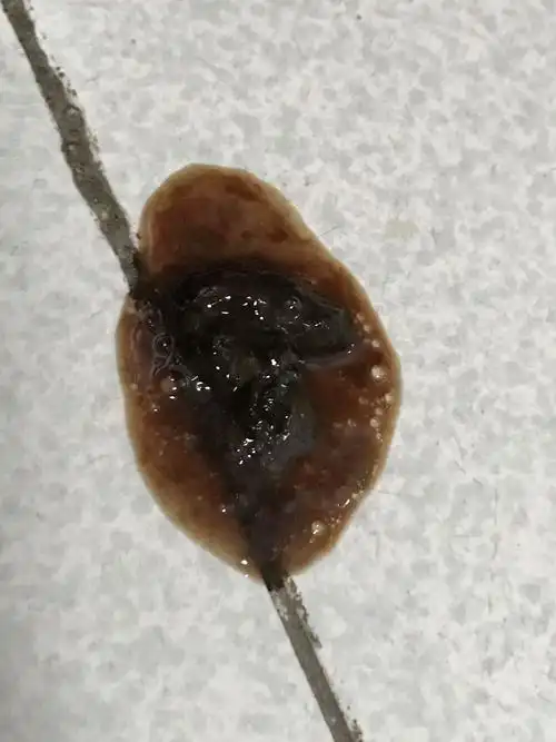 展开全部 细小病毒的整个病程是一周左右,你家狗狗已经第7天了,应该