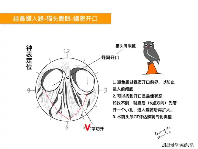 徐桂兴颅脑解剖手绘最新作品