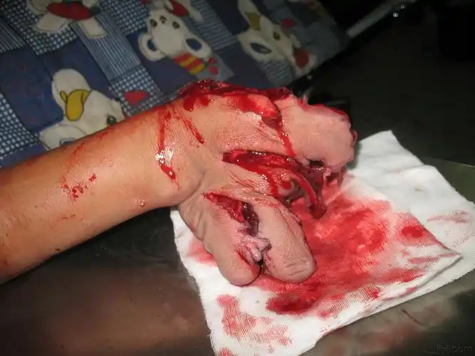 大家看看这手还有救吗