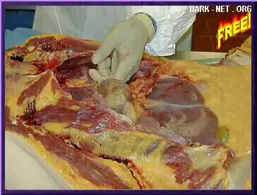 【贴图】部分医学解剖过程图片