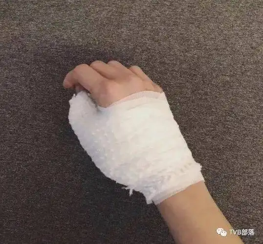 就忙于周围宣传电影,这日她就突然在社交网上载一张只手包扎的相,但就