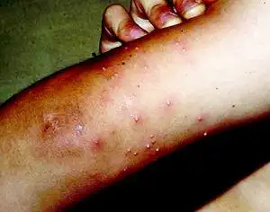 广东爆发红火蚁灾害(组图)