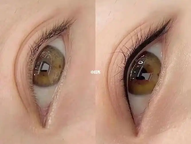 美瞳线前后对比