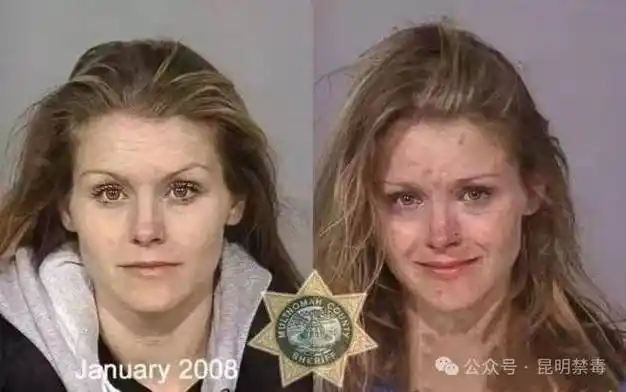 吸毒前后对比图堪称毁容胆小慎入