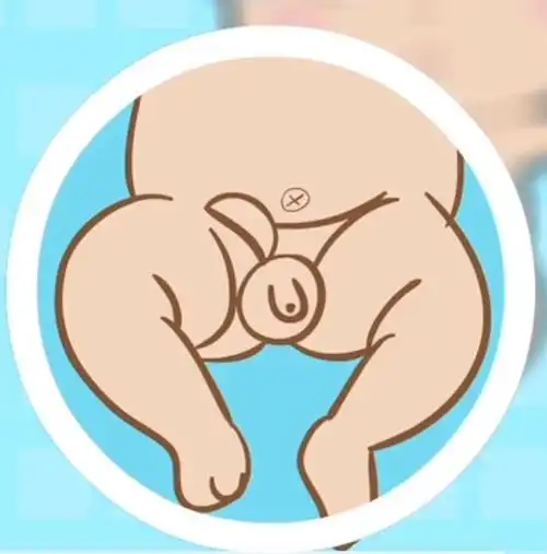 男宝宝疝气的症状图片46