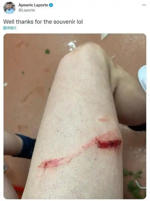 慎入拉波尔特赛后晒大腿伤口谢谢你送的纪念品哈哈