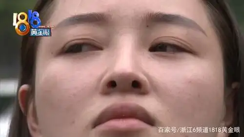 湖北赶到杭州做医美,再次赶来,因为鼻子歪了?