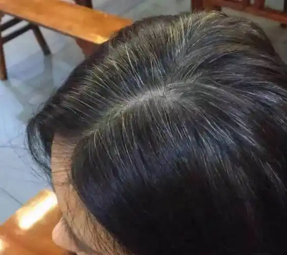 白发长在哪暗示不同问题吗?