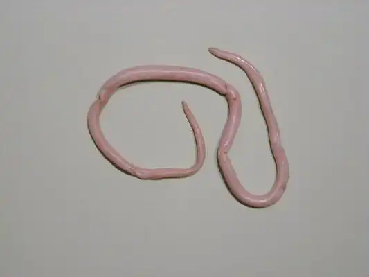 儿童肚子蛔虫图片45