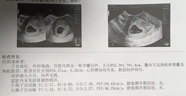 医生_双胞胎_时候