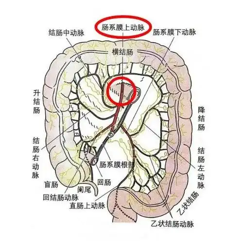 肠系上膜静脉血栓和肠系上膜动脉血栓一样吗