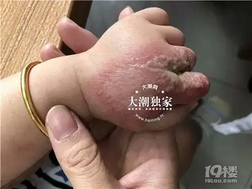 公园散步回来,十几个月大的孩子几乎