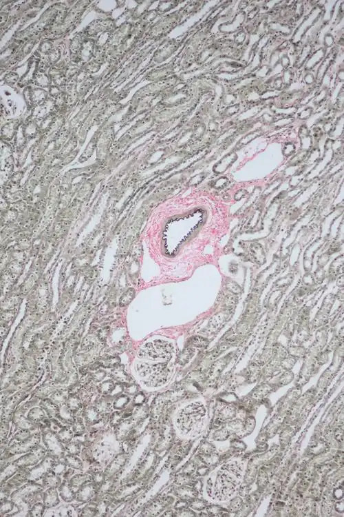 evg弹力纤维染色