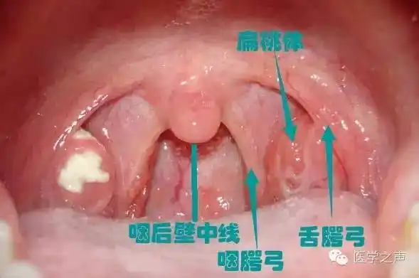 注:有些同学容易把咽腭弓和舌腭弓混淆.