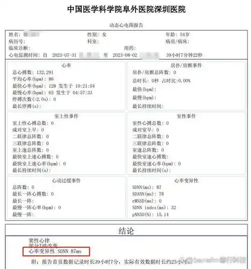 心血管病"侦察兵"——24小时动态心电图监测_检查_心脏_患者