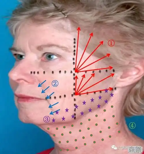 英诺提拉素效果对比