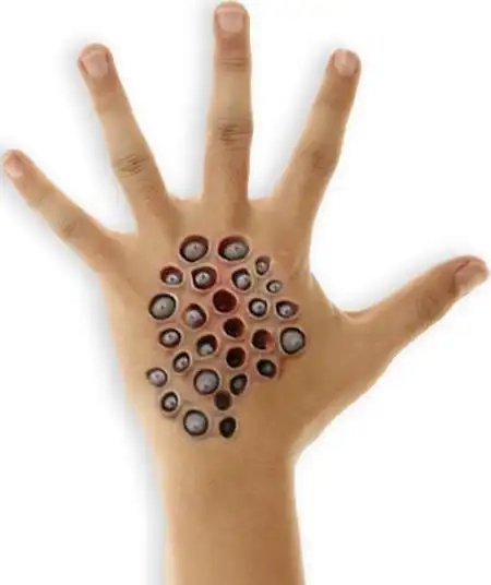 很多人认为是世界上最恶心的图片,尤其对于密集恐惧症,然而这样的图片